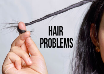 Natural Solutions To Stop Hair Fall