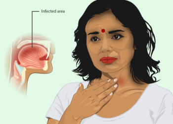 गले की समस्याएं