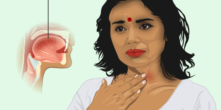 गले की समस्याएं